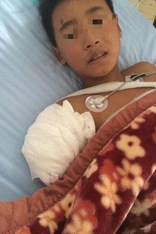 9岁男童右臂被黑熊咬掉 园方无人去医院看望(图)