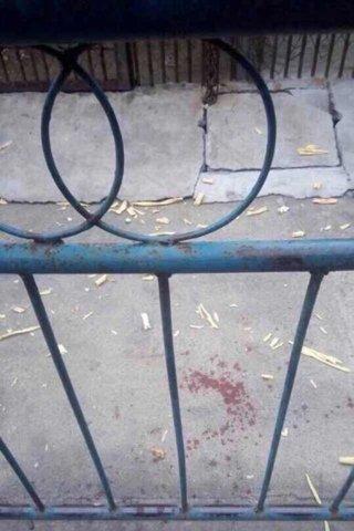 9岁男童右臂被黑熊咬掉 园方无人去医院看望(图)