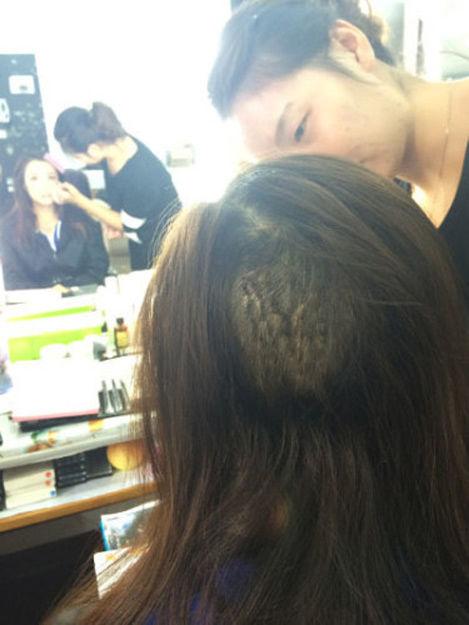 组图:叶璇宠物狗咬伤女星李依晓头部 致其缝20多针