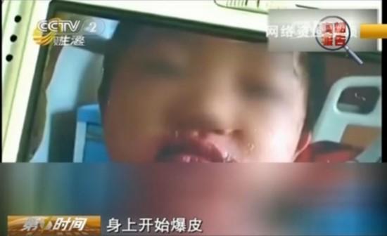 �����Ӵ�������ˮ��ȫ����Ƥ����������Ƶ��ͼ��